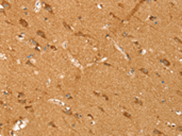 Anti-SIRT4 Rabbit Polyclonal Antibody