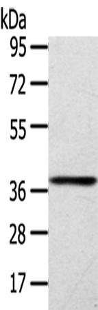 Anti-SIRT4 Rabbit Polyclonal Antibody