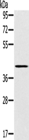 Anti-SLC14A1 Rabbit Polyclonal Antibody