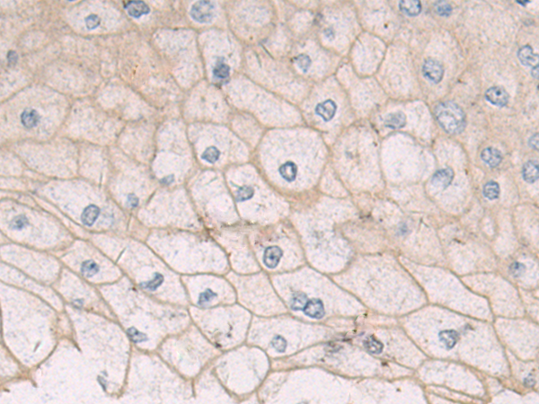 Anti-SLC16A3 Rabbit Polyclonal Antibody