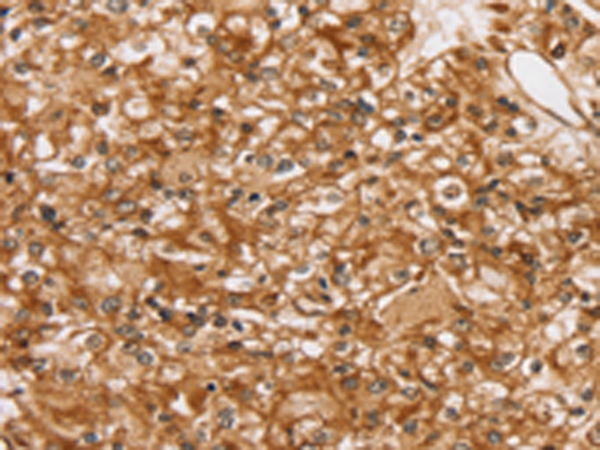 Anti-SLC16A8 Rabbit Polyclonal Antibody