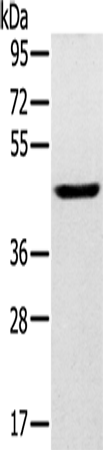 Anti-SLC16A8 Rabbit Polyclonal Antibody