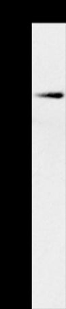 Anti-MCT 10 Rabbit Polyclonal Antibody