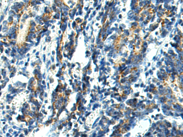 Anti-SLC16A11 Rabbit Polyclonal Antibody