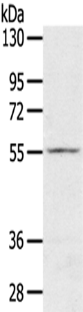 Anti-SLC16A11 Rabbit Polyclonal Antibody