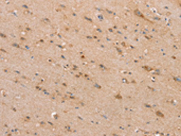 Anti-SLC25A20 Rabbit Polyclonal Antibody