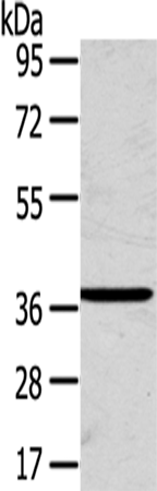 Anti-SLC25A20 Rabbit Polyclonal Antibody