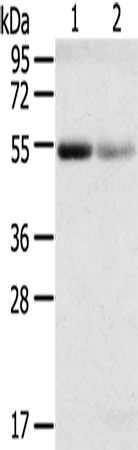 Anti-SLC17A1 Rabbit Polyclonal Antibody