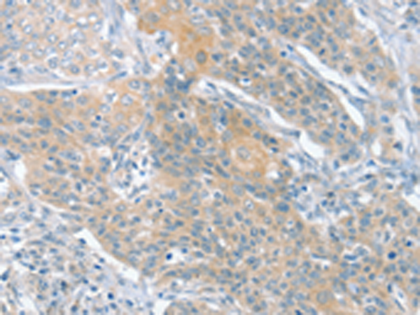 Anti-Slit2 Rabbit Polyclonal Antibody
