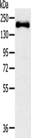 Anti-Slit2 Rabbit Polyclonal Antibody