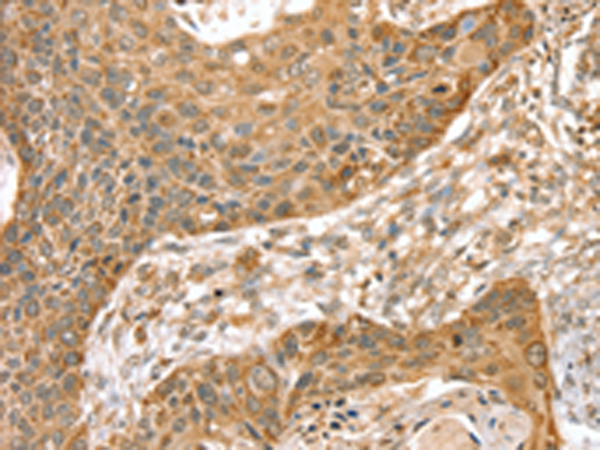 Anti-SMC4 Rabbit Polyclonal Antibody