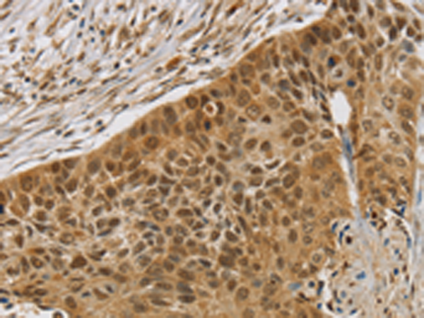 Anti-SMC6 Rabbit Polyclonal Antibody