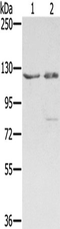 Anti-SMC6 Rabbit Polyclonal Antibody