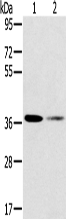 Anti-SMN Rabbit Polyclonal Antibody