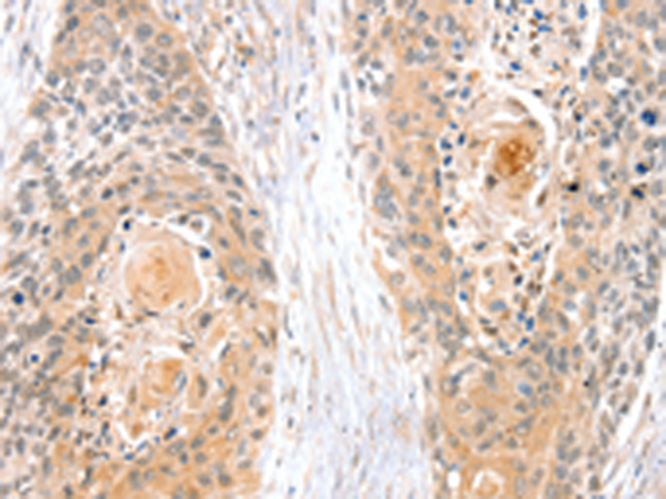 Anti-SNX3 Rabbit Polyclonal Antibody