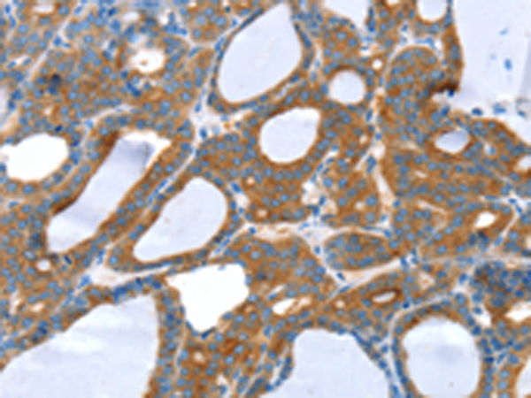 Anti-SNX5 Rabbit Polyclonal Antibody