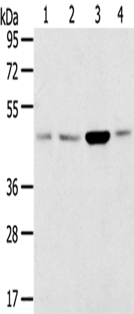 Anti-SNX5 Rabbit Polyclonal Antibody