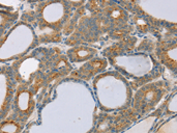 Anti-SNX30 Rabbit Polyclonal Antibody