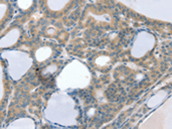 Anti-Superoxide Dismutase Copper Chaperone Rabbit Polyclonal Antibody