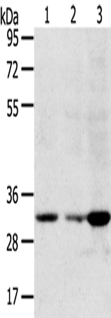 Anti-Superoxide Dismutase Copper Chaperone Rabbit Polyclonal Antibody