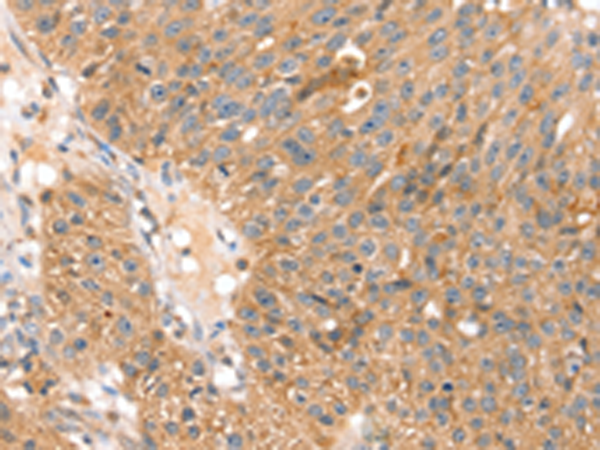 Anti-SOX11 Rabbit Polyclonal Antibody