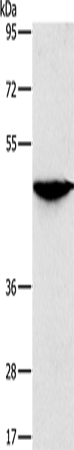 Anti-SOX11 Rabbit Polyclonal Antibody