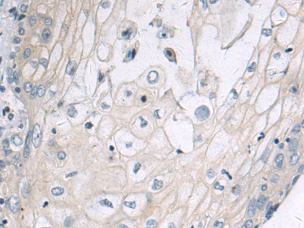 Anti-Syndecan 3 Rabbit Polyclonal Antibody