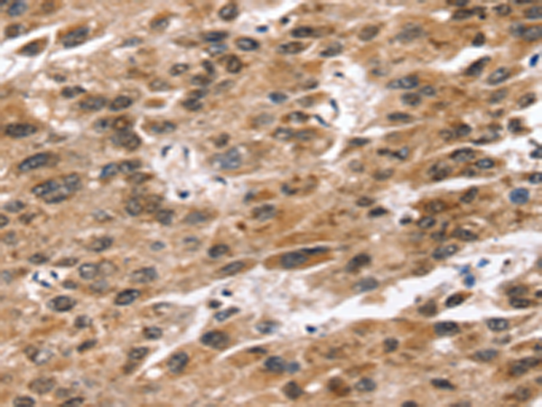 Anti-Syntrophin alpha 1 Rabbit Polyclonal Antibody