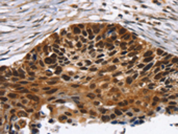 Anti-TACC2 Rabbit Polyclonal Antibody