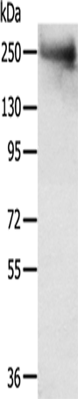 Anti-TACC2 Rabbit Polyclonal Antibody