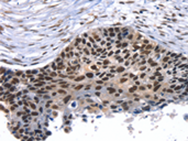 Anti-TAF15 Rabbit Polyclonal Antibody