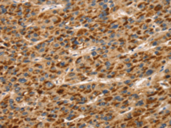 Anti-Talin 1 Rabbit Polyclonal Antibody