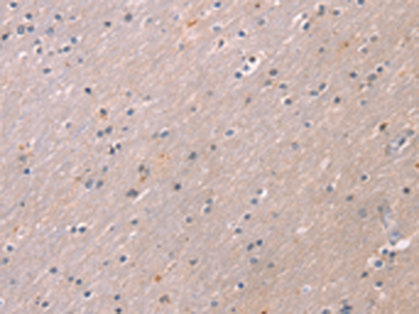 Anti-KCNK3 Rabbit Polyclonal Antibody