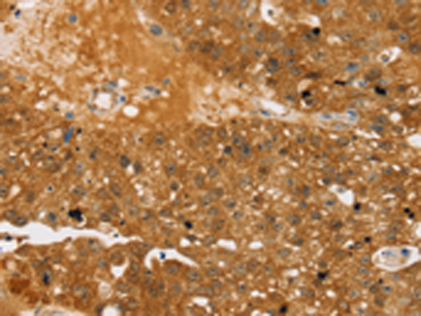 Anti-AS160 Rabbit Polyclonal Antibody