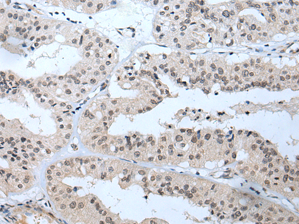 Anti-T Box Protein 1 Rabbit Polyclonal Antibody