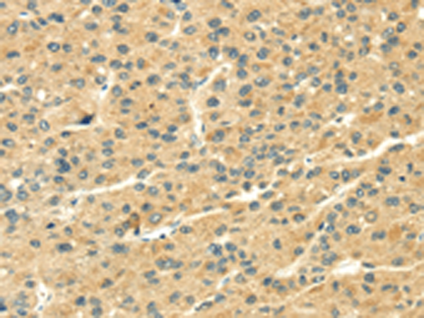 Anti-THAP3 Rabbit Polyclonal Antibody