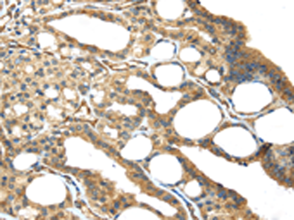 Anti-ISM2 Rabbit Polyclonal Antibody