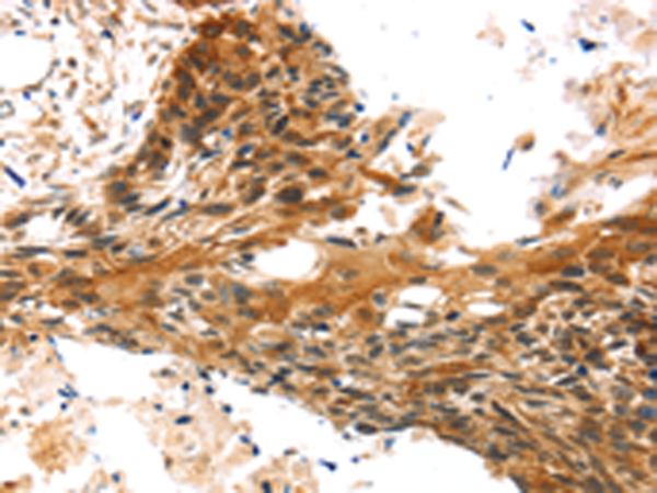Anti-TRIM35 Rabbit Polyclonal Antibody