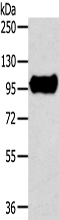 Anti-TRIM71 Rabbit Polyclonal Antibody