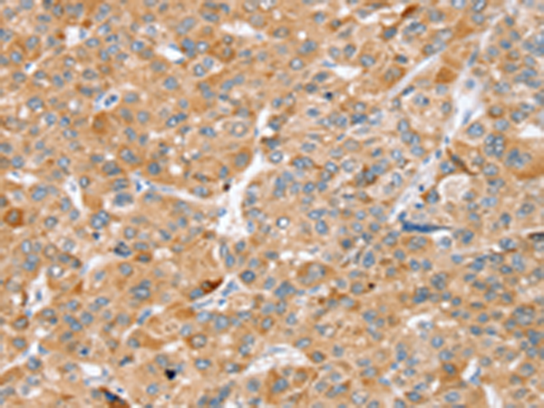 Anti-ZFP36L2 Rabbit Polyclonal Antibody