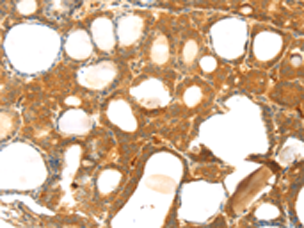 Anti-TM7SF2 Rabbit Polyclonal Antibody