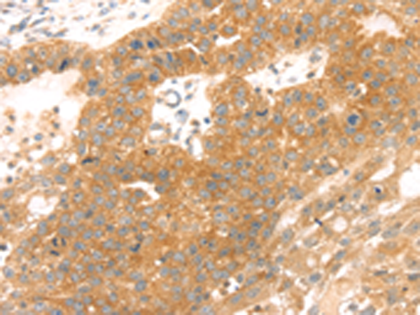 Anti-Tomoregulin 2 Rabbit Polyclonal Antibody