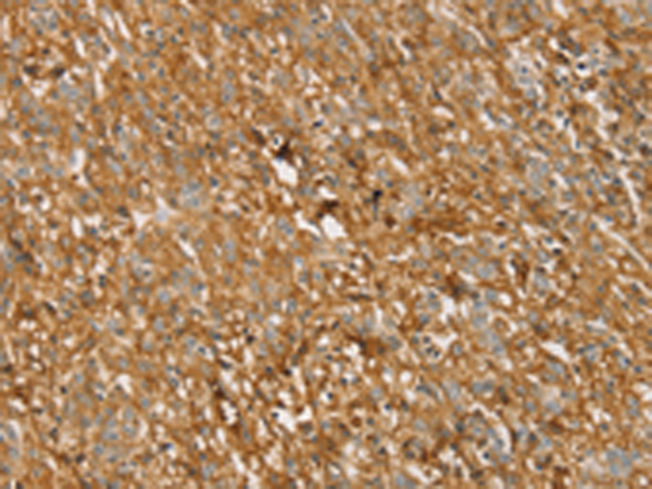 Anti-Transmembrane Protease Serine 11F Rabbit Polyclonal Antibody