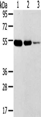 Anti-Transmembrane Protease Serine 11F Rabbit Polyclonal Antibody