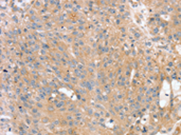 Anti-Pentraxin 3 Rabbit Polyclonal Antibody