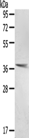 Anti-Pentraxin 3 Rabbit Polyclonal Antibody