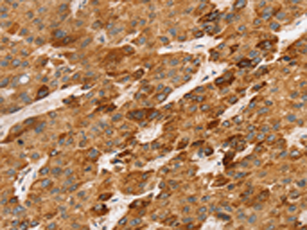 Anti-LTB Rabbit Polyclonal Antibody