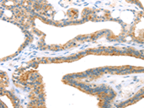 Anti-TNIP2 Rabbit Polyclonal Antibody
