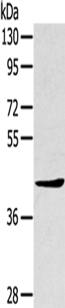 Anti-TNIP2 Rabbit Polyclonal Antibody