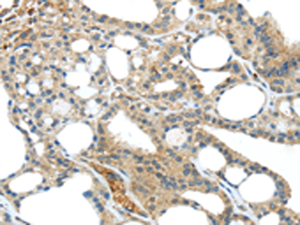 Anti-TNIP1 Rabbit Polyclonal Antibody